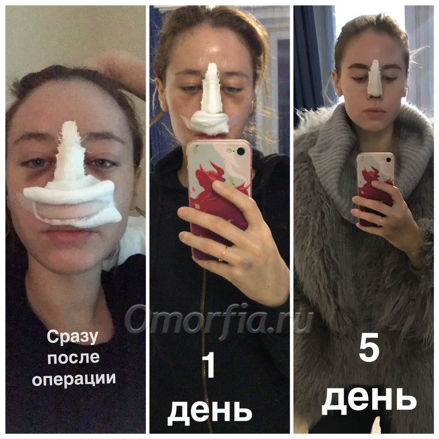 ОП
