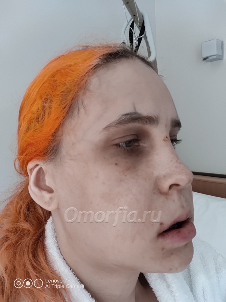на утро послек операции 2