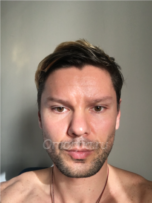 Фото "До"