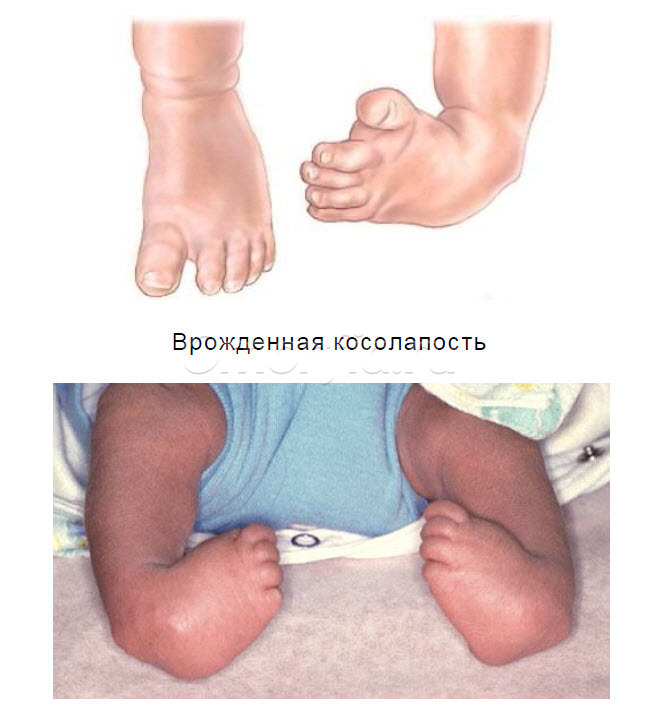 Image title