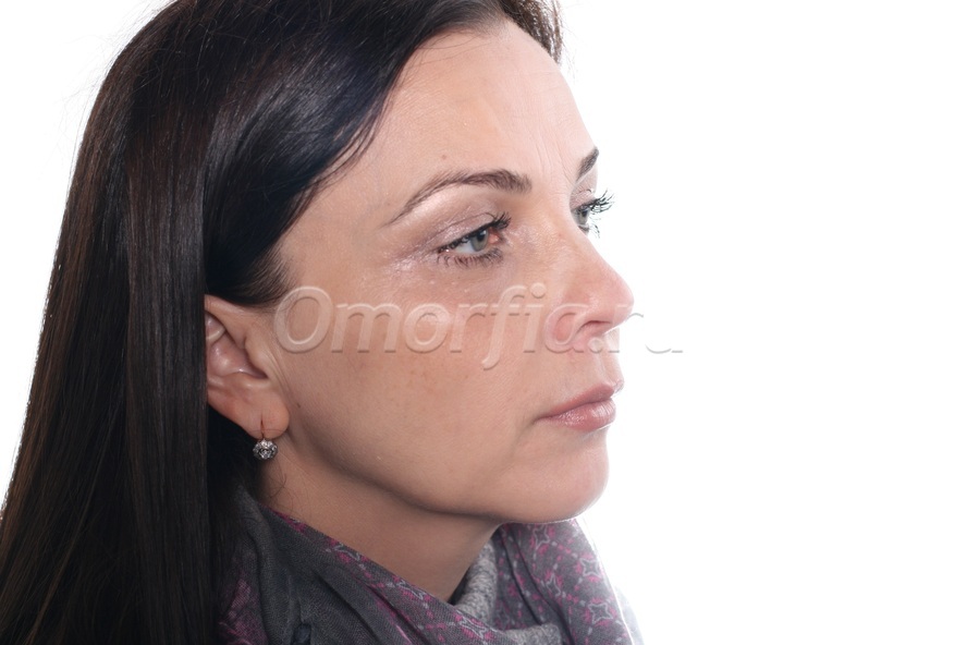 Image title