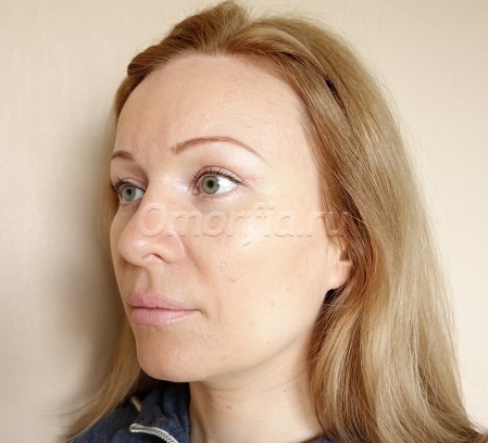 Image title