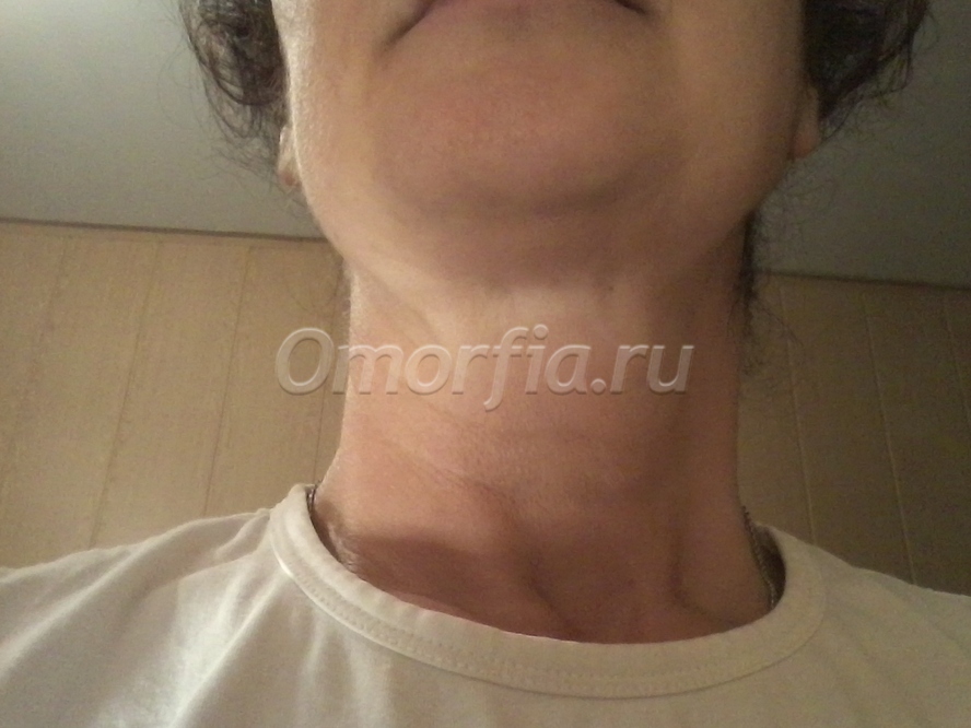 Image title