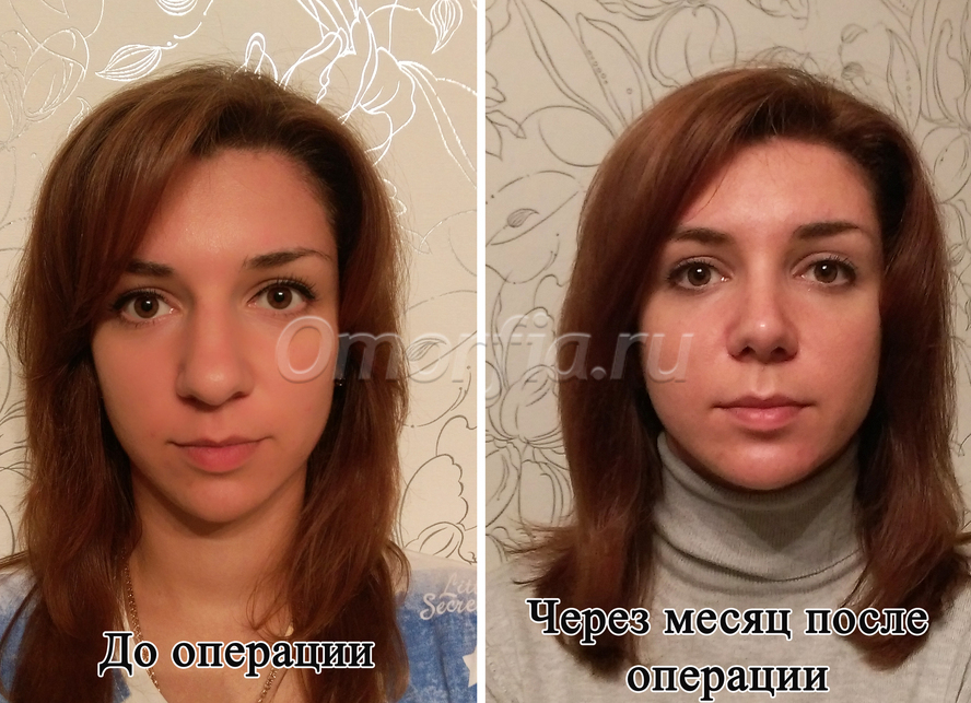 Image title