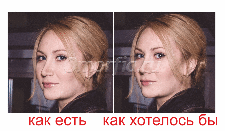 Image title