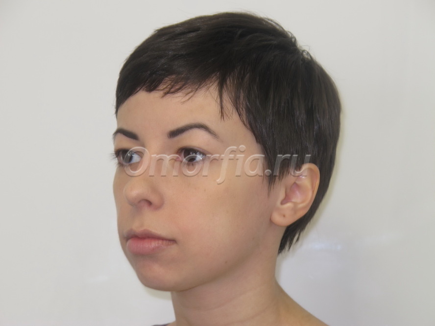 Image title