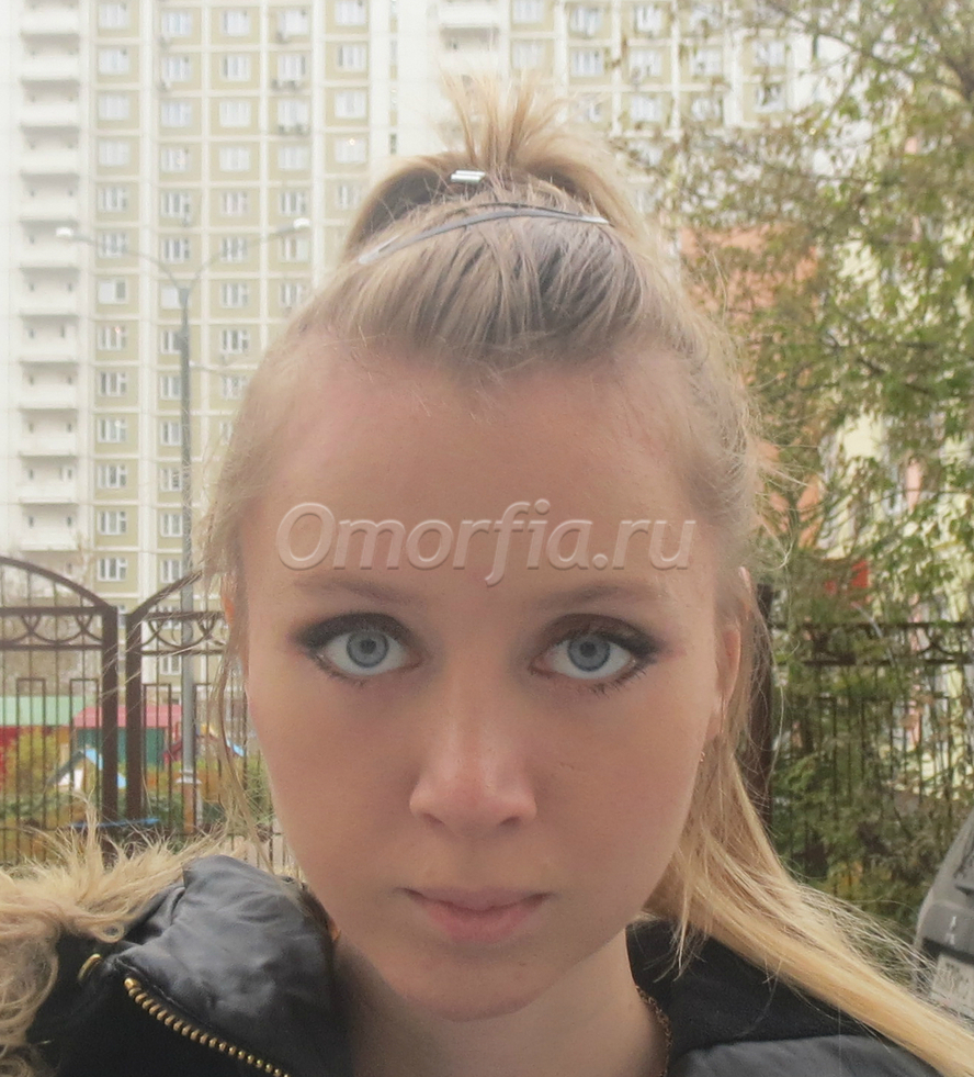 Image title