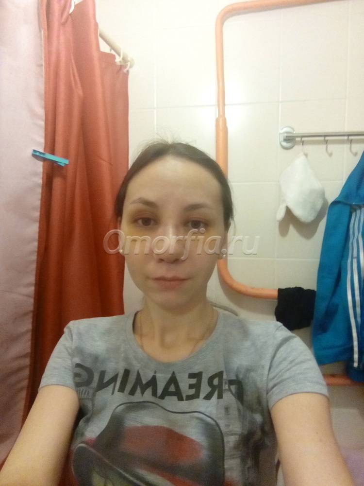 Image title