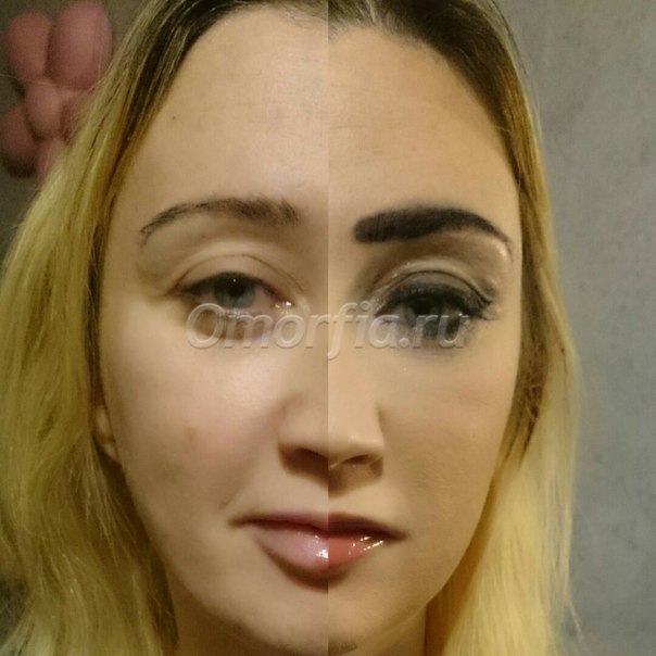 Image title
