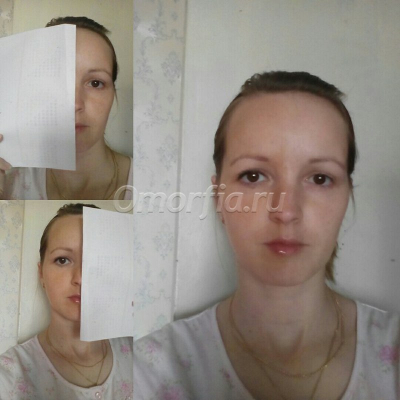 Image title