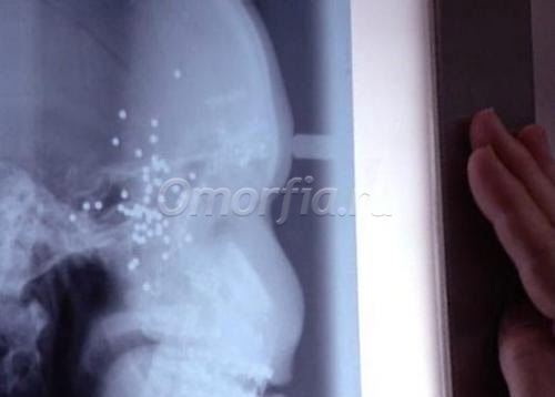 Женщине сделали силиконовое лицо - www.doctorGev.org