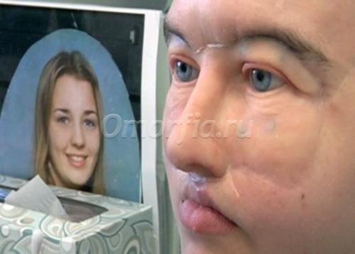 Женщине сделали силиконовое лицо - www.doctorGev.org